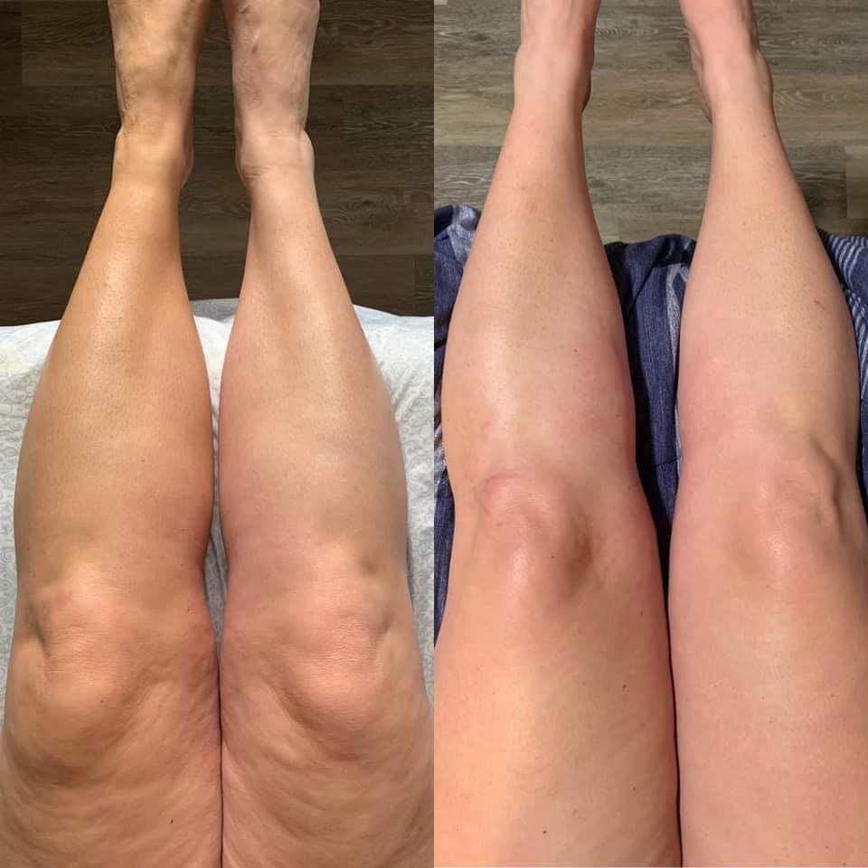 Pensé pour faire oublier la cellulite